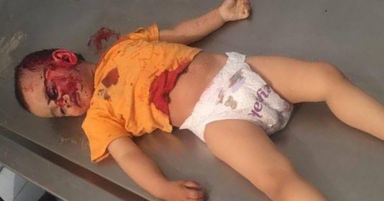 Армяне убили двухлетнюю азербайджанскую девочку — ФОТО