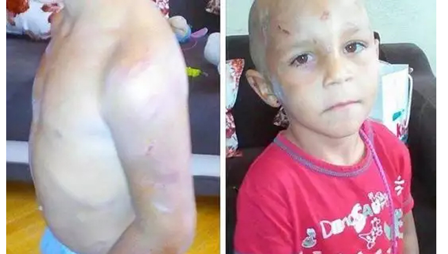 В Баку четырехлетнего ребенка жестоко избивали из-за денег — ФОТО