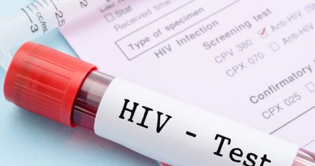 За 3 месяца в Азербайджане 148 человек заразились ВИЧ