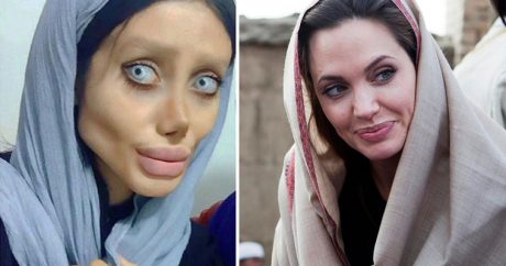 Иранка сделала 50 операций, чтобы быть похожей на Анджелину Джоли — ФОТО