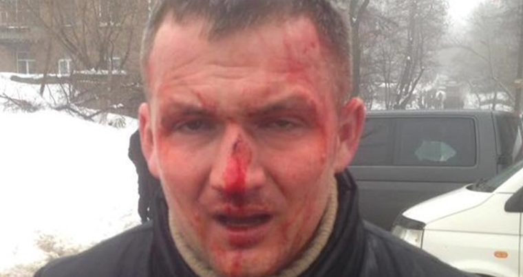 Депутата зверски избили на улице — ВИДЕО