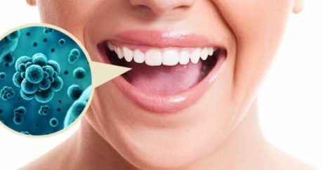 Запах изо рта: всегда ли зубы виноваты?
