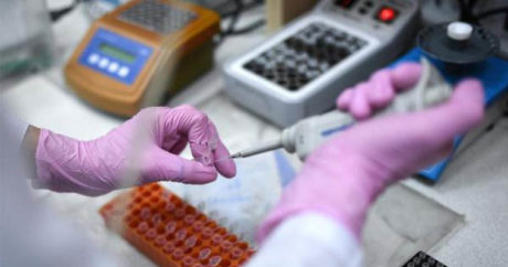Россия поставила тесты для диагностики коронавируса в Азербайджан