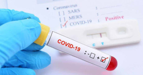 В Азербайджане подтверждено 30 новых случаев заражения коронавирусом