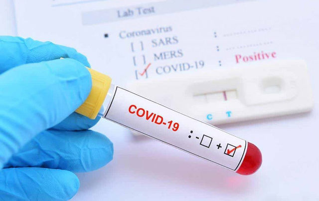 В Азербайджане подтверждено 30 новых случаев заражения коронавирусом