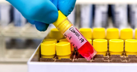 В Азербайджане еще 131 человек заразился коронавирусом, 143 выздоровели