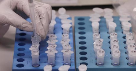 Клиника разработала первый генетический тест на коронавирус