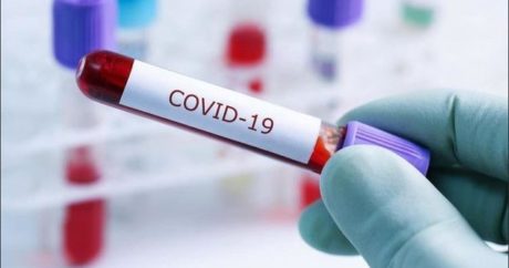 Выявлено еще 76 случаев заражения коронавирусом, вылечились 28 человек