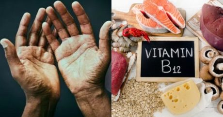 6 признаков того, что у вас дефицит витаминов группы В