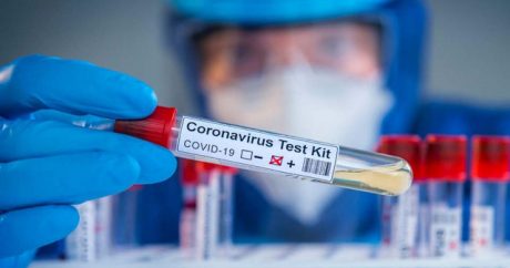 В Азербайджане коронавирусом заразились еще 590 человек, 7 скончались