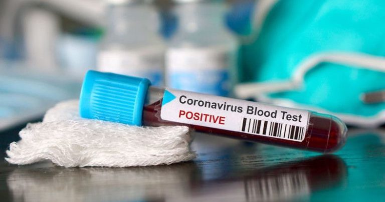 Число зараженных коронавирусом в Турции выросло за сутки на 919