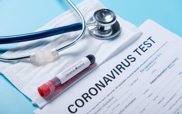 Помимо теста-мазка на COVİD-19 следует сдавать и анализ на кровь