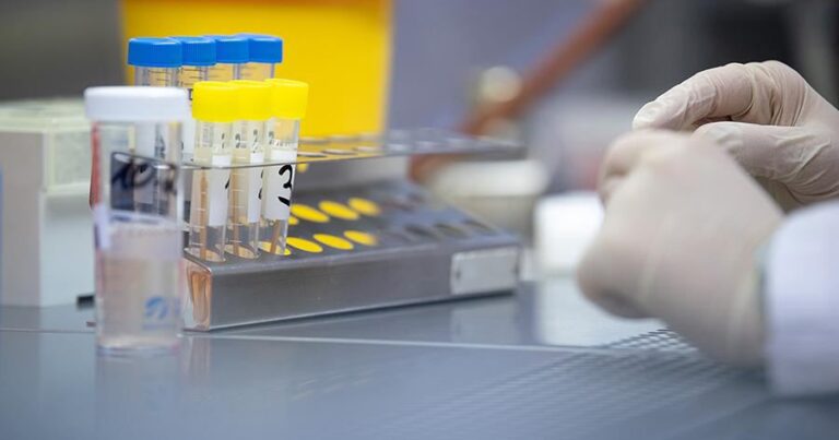 Более 150 тысяч ПЦР-тестов на коронавирус провели в Атырауской области