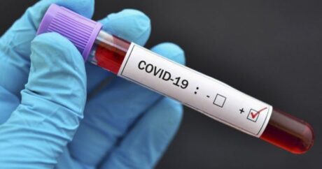 Инфекционист раскрыл причины повторного заражения коронавирусом