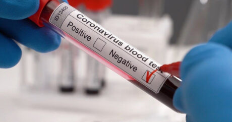 В Сингапуре начнут использовать систему тестирования на коронавирус через дыхание