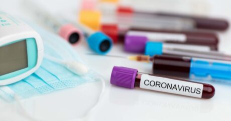В Азербайджане за сутки коронавирусом заразились 472 человека