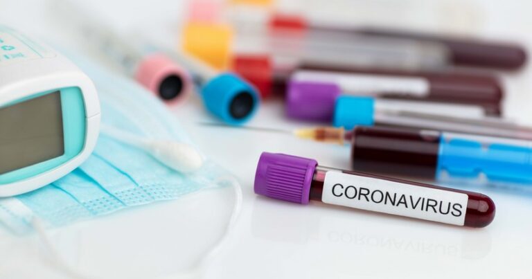 В Азербайджане за сутки коронавирусом заразились 472 человека