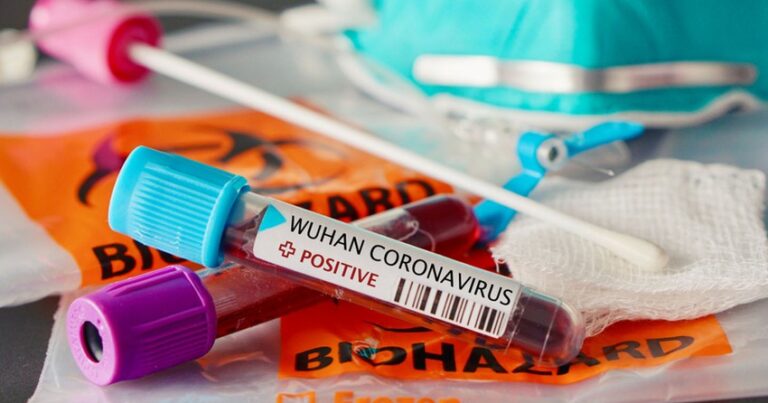 В Азербайджане за сутки коронавирусом заразились 4 129 человек