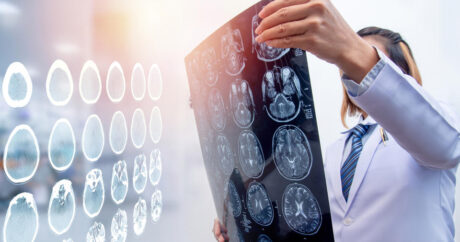 Эпилепсию научились лечить при помощи искусственного интеллекта