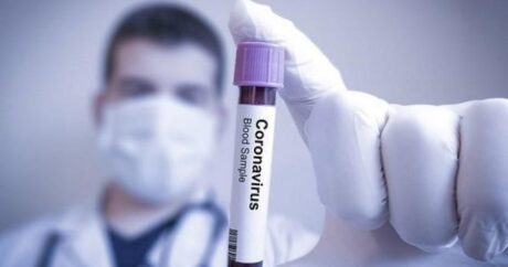Симптомы коронавируса изменились — главный инфекционист Азербайджана