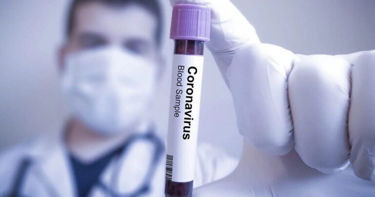 В Азербайджане за сутки коронавирусом заразились 2 233 человека