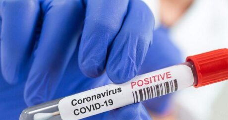 В Азербайджане за сутки коронавирусом заразились 1 617 человек