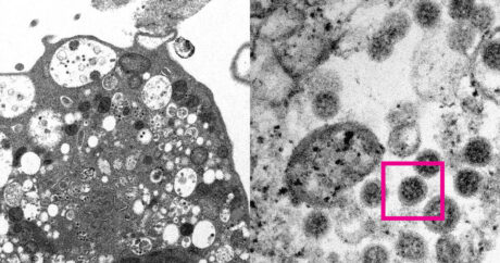 Ученые сумели сфотографировать «омикрон»-штамм коронавируса