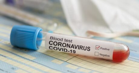 В Азербайджане за сутки коронавирусом заразились 38 человек