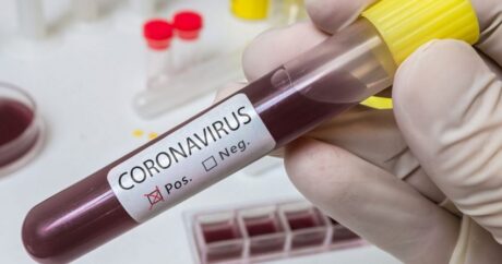 В Азербайджане за последние сутки не выявлено случаев заражения коронавирусом