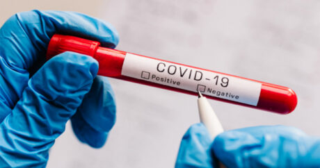 В Азербайджане количество проведенных тестов по выявлению коронавируса превысило 7 млн