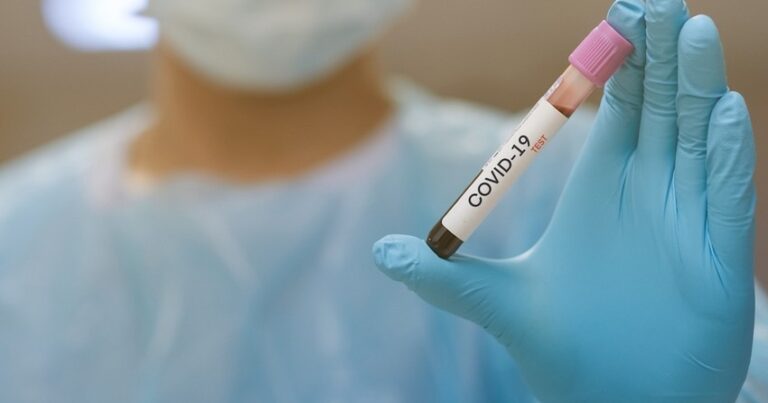 В Азербайджане коронавирусом заразились еще 325 человек