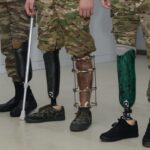 В Азербайджане высокотехнологичными протезами обеспечены 352 ветерана войны