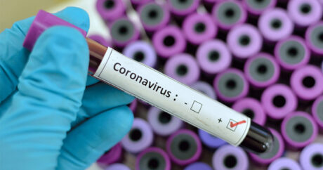 В Азербайджане еще 67 человек заразились коронавирусом