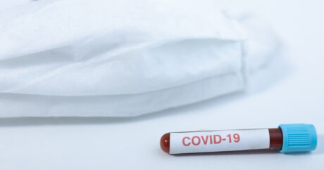 В Азербайджане за сутки 22 человека заразились коронавирусом, пятеро скончались