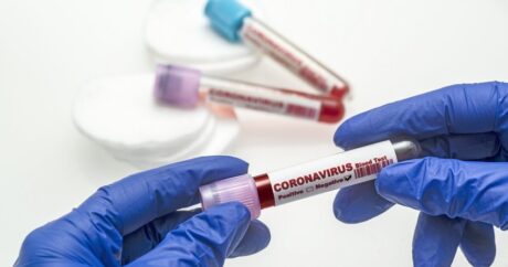 В Азербайджане за сутки 20 человек заразились коронавирусом