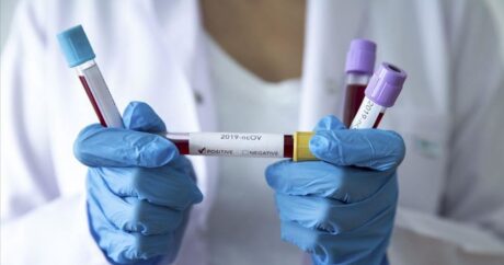 В Азербайджане выявлено еще 65 случаев заражения коронавирусом