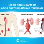 В 2024 году по ОМС выполнено 256 операций по протезированию аневризмы аорты